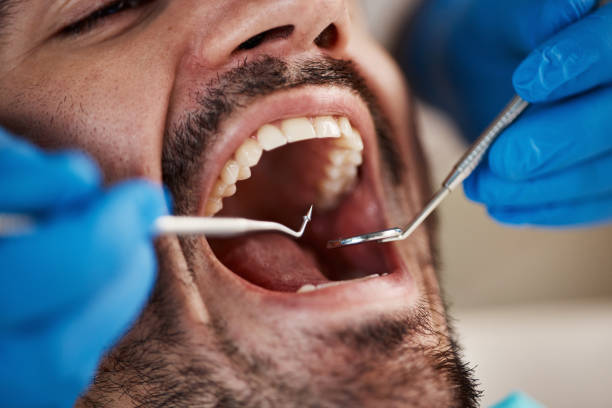 Best Sedation Dentistry  in Magnolia, OH